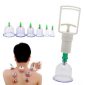 cupping-therapy-500x500-1-1.jpg